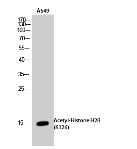 Fig.2. Western Blot analysis of A549 cells using Acetyl-Histone H2B (K126) Polyclonal Antibody. Secondary Antibody  was diluted at 1:20000.