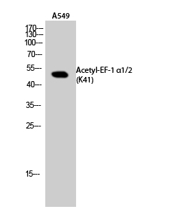 Fig.2. Western Blot analysis of A549 cells using Acetyl-EF-1 α1/2 (K41) Polyclonal Antibody. Secondary Antibody was diluted at 1:20000.