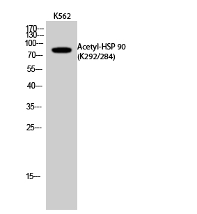 Fig.2. Western Blot analysis of K562 cells using Acetyl-HSP 90 (K292/284) Polyclonal Antibody. Secondary Antibody was diluted at 1:20000.