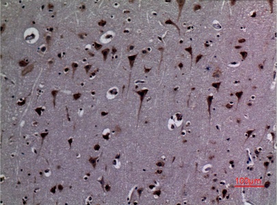 Fig.5. Immunohistochemical analysis of paraffin-embedded human-brain, antibody was diluted at 1:100.