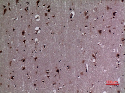 Fig.6. Immunohistochemical analysis of paraffin-embedded human-brain, antibody was diluted at 1:100.