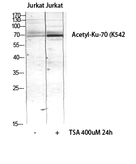 Fig.2. Western blot analysis of JK lysis using Acetyl-Ku-70 (K542) antibody. Secondary Antibody  was diluted at 1:20000.