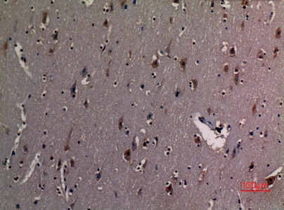 Fig.5. Immunohistochemical analysis of paraffin-embedded human-brain, antibody was diluted at 1:100.