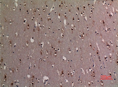 Fig.6. Immunohistochemical analysis of paraffin-embedded human-brain, antibody was diluted at 1:100.