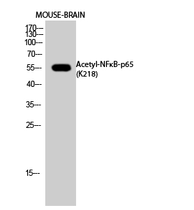Fig.2. Western Blot analysis of MOUSE-BRAIN cells using Acetyl-NFκB-p65 (K218) Polyclonal Antibody diluted at 1:1000. Secondary Antibody was diluted at 1:20000.