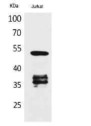Fig.1. Western Blot analysis of Jurkat cells using Acetyl-p53 (K370) Polyclonal Antibody. Antibody was diluted at 1:1000. Secondary Antibody was diluted at 1:20000.