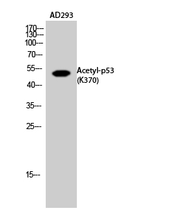 Fig.2. Western Blot analysis of AD293 cells using Acetyl-p53 (K370) Polyclonal Antibody diluted at 1:1000. Secondary Antibody  was diluted at 1:20000.