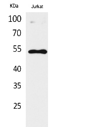 Fig.1. Western Blot analysis of Jurkat cells using Acetyl-p53 (K372) Polyclonal Antibody. Antibody was diluted at 1:2000. Secondary Antibody was diluted at 1:20000.