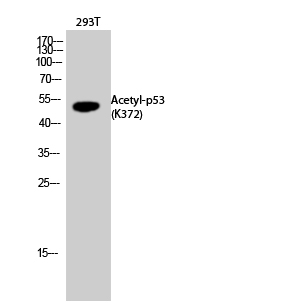 Fig.2. Western Blot analysis of 293T cells using Acetyl-p53 (K372) Polyclonal Antibody diluted at 1:2000. Secondary Antibody  was diluted at 1:20000.