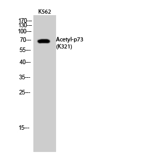 Fig.2. Western Blot analysis of K562 cells using Acetyl-p73 (K321) Polyclonal Antibody. Secondary Antibody  was diluted at 1:20000.