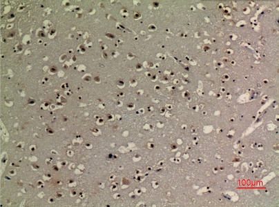 Fig.5. Immunohistochemical analysis of paraffin-embedded human-brain, antibody was diluted at 1:100.