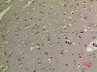 Fig.6. Immunohistochemical analysis of paraffin-embedded human-brain, antibody was diluted at 1:100.