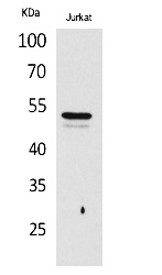 Fig.1. Western Blot analysis of Jurkat cells using Acetyl-Tubulin α (K40) Polyclonal Antibody. Secondary Antibody was diluted at 1:20000.