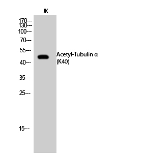 Fig.2. Western Blot analysis of JK cells using Acetyl-Tubulin α (K40) Polyclonal Antibody. Secondary Antibody  was diluted at 1:20000.