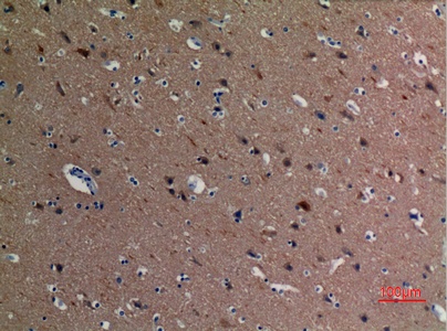 Fig.5. Immunohistochemical analysis of paraffin-embedded human-brain, antibody was diluted at 1:100.