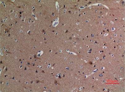 Fig.6. Immunohistochemical analysis of paraffin-embedded human-brain, antibody was diluted at 1:100.