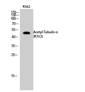 Fig.2. Western Blot analysis of K562 cells using Acetyl-Tubulin α (K352) Polyclonal Antibody. Secondary Antibody  was diluted at 1:20000.