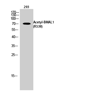 Fig. Western Blot analysis of 293 cells using Acetyl-BMAL1 (K538) Polyclonal Antibody. Secondary Antibody  was diluted at 1:20000.