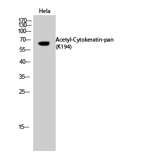 Fig. Western Blot analysis of HeLa cells using Acetyl-Cytokeratin-pan (K194) Polyclonal Antibody. Secondary Antibody was diluted at 1:20000.