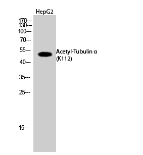 Fig. Western Blot analysis of HepG2 cells using Acetyl-Tubulin α (K112) Polyclonal Antibody. Secondary Antibody  was diluted at 1:20000.