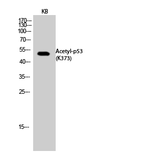 Fig.2. Western Blot analysis of KB cells using Acetyl-p53 (K373) Polyclonal Antibody. Secondary Antibody was diluted at 1:20000.