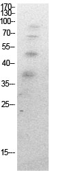 Fig.1. Western Blot analysis of HeLa cells using Acetyl-Ub (K27) Polyclonal Antibody. Secondary Antibody was diluted at 1:20000.
