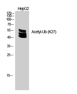 Fig.2. Western Blot analysis of HEPG2 cells using Acetyl-Ub (K27) Polyclonal Antibody. Secondary Antibody  was diluted at 1:20000.