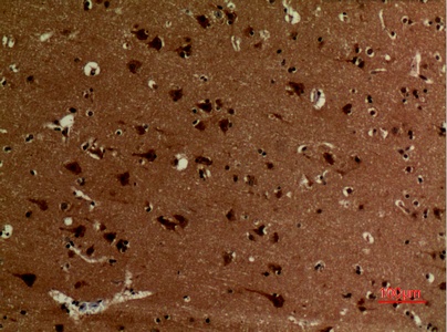 Fig.5. Immunohistochemical analysis of paraffin-embedded human-brain, antibody was diluted at 1:100.