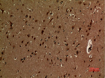 Fig.6. Immunohistochemical analysis of paraffin-embedded human-brain, antibody was diluted at 1:100.