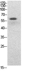 Fig.1. Western Blot analysis of HeLa, HepG2 cells using Acetyl-NFκB-p65 (K314/K315) Polyclonal Antibody. Secondary Antibody  was diluted at 1:20000.