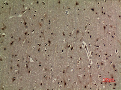 Fig.5. Immunohistochemical analysis of paraffin-embedded human-brain, antibody was diluted at 1:100.
