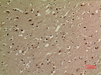 Fig.6. Immunohistochemical analysis of paraffin-embedded human-brain, antibody was diluted at 1:100.