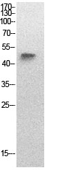 Fig.1. Western Blot analysis of SKW3 cells using Acetyl-p53 (K320) Polyclonal Antibody. Secondary Antibody  was diluted at 1:20000.