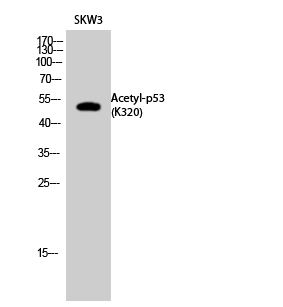 Fig.2. Western Blot analysis of SKW3 cells using Acetyl-p53 (K320) Polyclonal Antibody. Secondary Antibody  was diluted at 1:20000.
