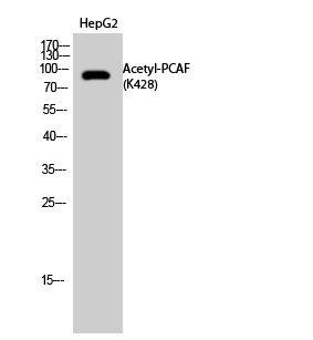 Fig.2. Western Blot analysis of HepG2 cells using Acetyl-PCAF (K428) Polyclonal Antibody. Secondary Antibody  was diluted at 1:20000.