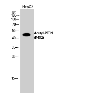 Fig.2. Western Blot analysis of HepG2 cells using Acetyl-PTEN (K402) Polyclonal Antibody. Secondary Antibody  was diluted at 1:20000.