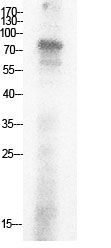 Fig.1. Western Blot analysis of HepG2 cells using Acetyl-Ub (K29) Polyclonal Antibody. Secondary Antibody  was diluted at 1:20000.