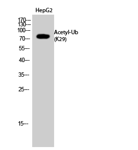 Fig.2. Western Blot analysis of HepG2 cells using Acetyl-Ub (K29) Polyclonal Antibody. Secondary Antibody  was diluted at 1:20000.