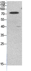 Fig.1. Western Blot analysis of HeLa cells using Acetyl-Ub (K48) Polyclonal Antibody. Secondary Antibody was diluted at 1:20000.