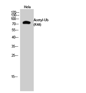 Fig.2. Western Blot analysis of Hela cells using Acetyl-Ub (K48) Polyclonal Antibody. Secondary Antibody  was diluted at 1:20000.