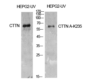 Fig.1. Western Blot analysis of HepG2-UV cells using Acetyl-Cortactin (K235) Polyclonal Antibody. Antibody was diluted at 1:500. Secondary Antibody was diluted at 1:20000.