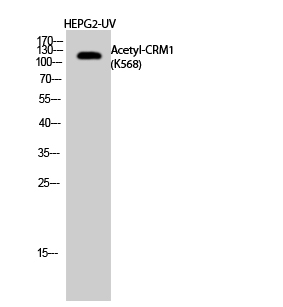 Fig.2. Western Blot analysis of HEPG2-UV cells using Acetyl-CRM1 (K568) Polyclonal Antibody diluted at 1:500. Secondary Antibody was diluted at 1:20000.