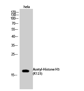 Fig.1. Western Blot analysis of Hela cells using Acetyl-Histone H3 (K123) Polyclonal Antibody. Antibody was diluted at 1:1000. Secondary Antibody was diluted at 1:20000.