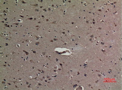 Fig.3. Immunohistochemical analysis of paraffin-embedded human-brain, antibody was diluted at 1:100.