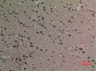 Fig.4. Immunohistochemical analysis of paraffin-embedded human-brain, antibody was diluted at 1:100.