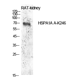 Fig.1. Western Blot analysis of rat kidney cells using Acetyl-HSP70 (K246) Polyclonal Antibody. Antibody was diluted at 1:1000. Secondary Antibody  was diluted at 1:20000.