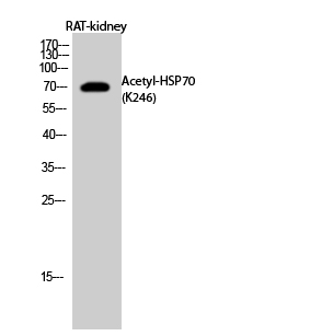 Fig.2. Western Blot analysis of RAT-kidney cells using Acetyl-HSP70 (K246) Polyclonal Antibody diluted at 1:1000. Secondary Antibody  was diluted at 1:20000.
