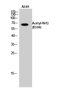 Fig.1. Western Blot analysis of A549 cells using Acetyl-Nrf2 (K599) Polyclonal Antibody. Antibody was diluted at 1:1000. Secondary Antibody  was diluted at 1:20000.