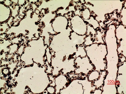 Fig.2. Immunohistochemical analysis of paraffin-embedded rat-lung, antibody was diluted at 1:100.
