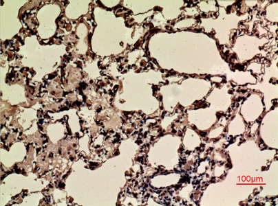 Fig.3. Immunohistochemical analysis of paraffin-embedded rat-lung, antibody was diluted at 1:100.